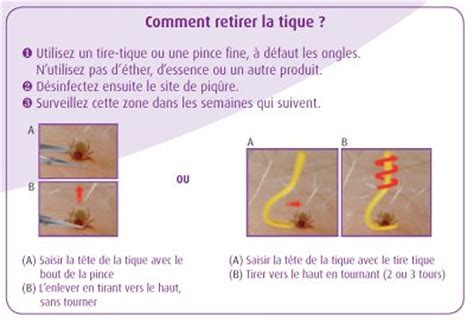 enlever tique