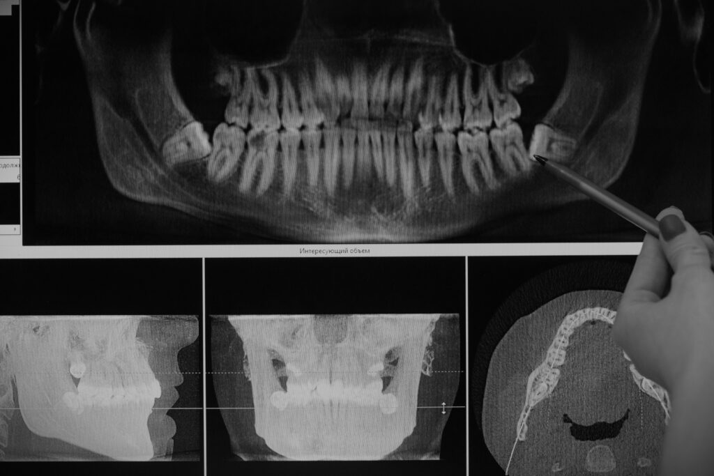Portraits criminels par Swen : Ed Kemper